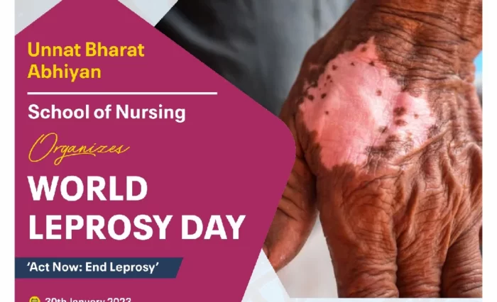 World Leprosy Day- “Act Now End Leprosy”